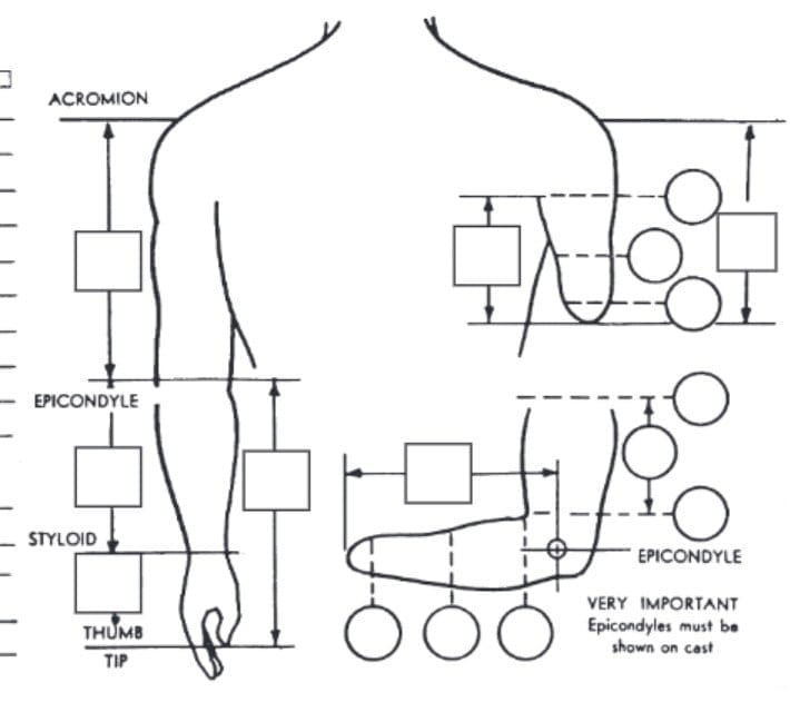 Upper Extremity Prosthesis Form