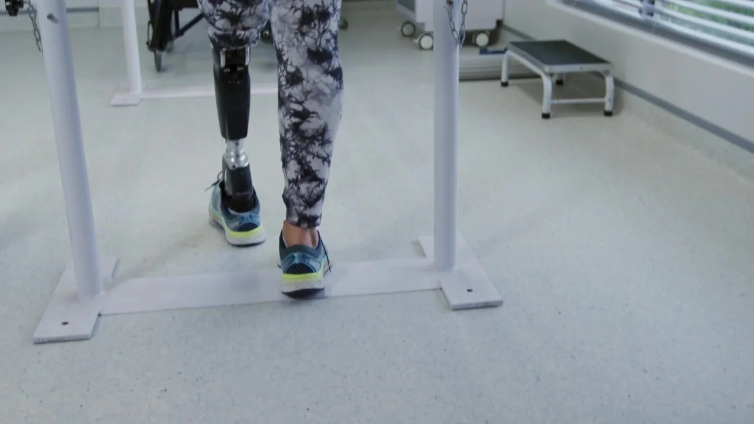 Prosthetics Leg